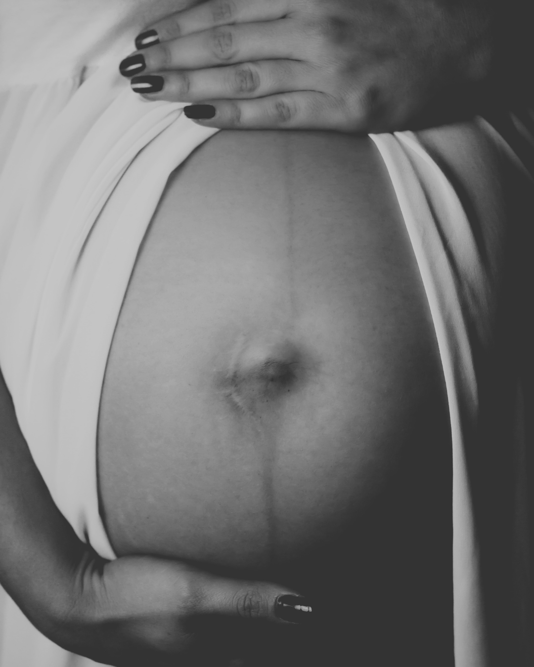 Grossesse : votre peau vous parle, ce qu'elle essaie de vous dire.